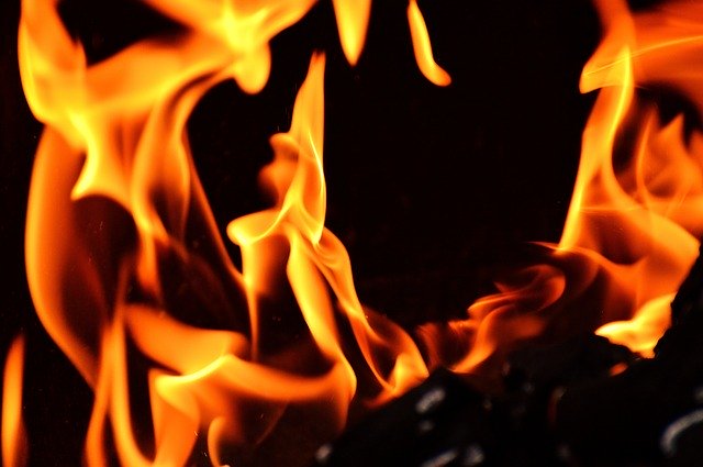  Woman dies of burn injuries in Udupi
