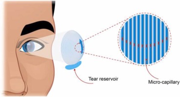  Researchers from MAHE report development of 3D printed self-moisturizing contact lens